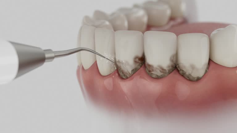 Trusted Tooth Extraction service in Vicksburg, MS - Dentist Open Now